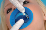 OptraDam Plus. Трехмерный раббердам 50 шт